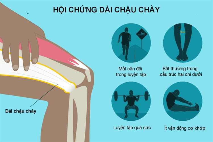 Hội chứng dải chậu chày do nhiều nguyên nhân tập luyện sai cách 